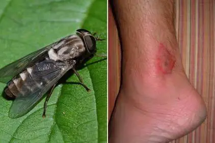 Horsefly Bites