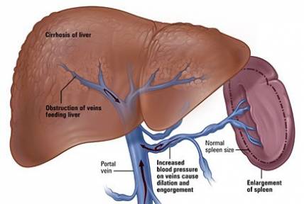 What are high liver enzymes?