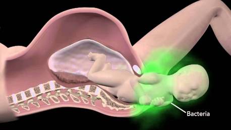 group b strep test in pregnancy