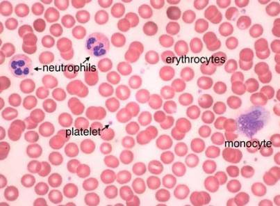 Blood Smear Test: Procedure and Results Meaning | IYTmed.com