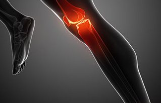 Anterior Knee Pain