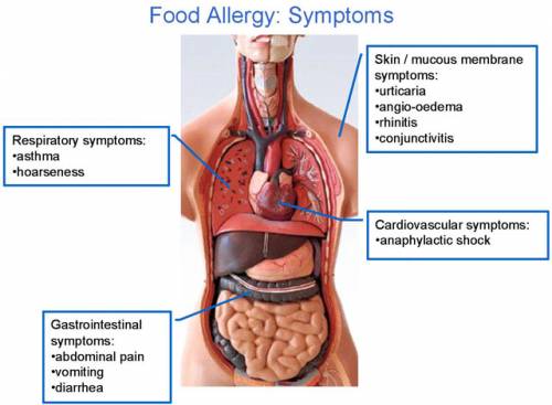 signs of allergic reactions