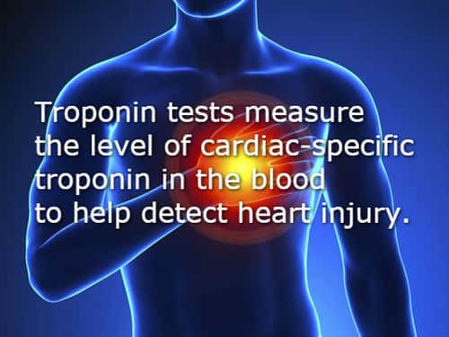 istat troponin procedure