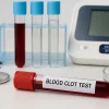 lood sample tube labeled “Blood Clot Test” on a lab table with diagnostic tools — symbolizing medical testing for clot recovery and vein health.