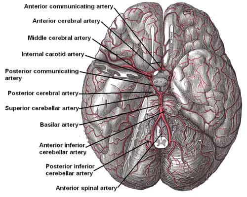 Brain Aneurysm Prognosis