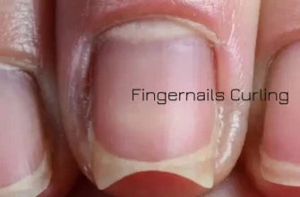 Close-up of hands showing mildly curved fingernails with a subtle natural bend, illustrating a slight deviation from normal nail shape without visible damage