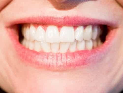gum pain between teeth