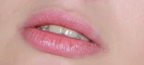 Girl's lips changed color