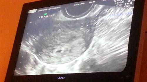 ultrasound at 4 weeks pregnancy