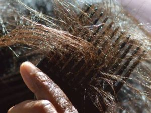Main Causes Of Hair Breakage You Should Know Iytmed Main Causes Of Hair Breakage You Should Know Iytmed