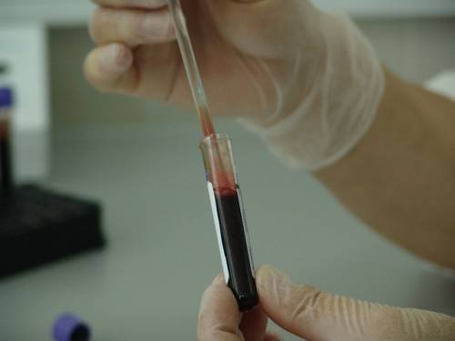 Blood taken for rapid plasma reagin test