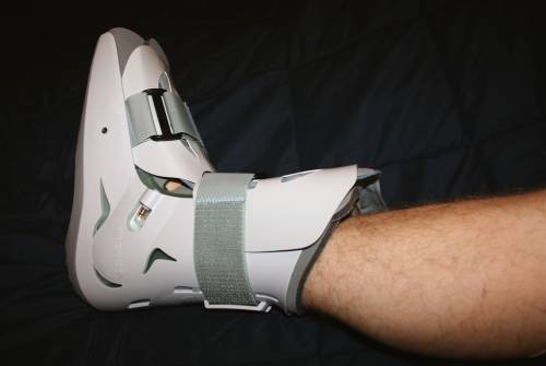 Feeling Stress Fracture in the Foot