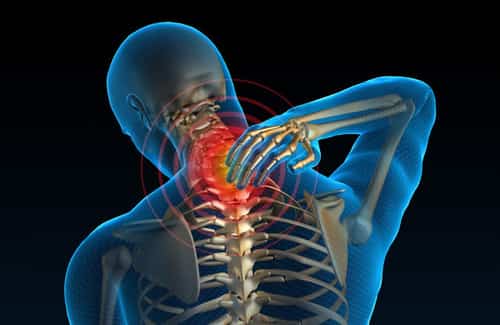 neck stiffness and pain