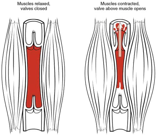 Pulled Calf Muscle