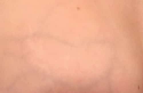 Part of woman's breast with blue veins