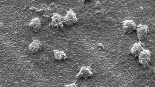 How Klebsiella Pneumoniae infection looks in microscope