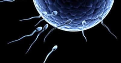 Why your sperm looks yellow