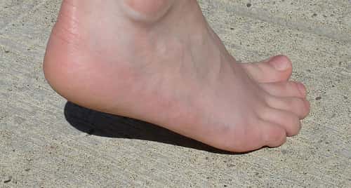 discomfort or swelling in the back of your heel.
