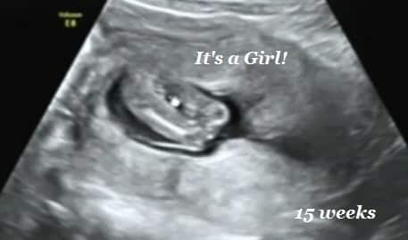 Girl (gender) recognized on 15 weeks utrasound test