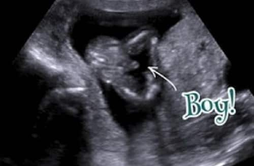 15 week fetus 3d ultrasound