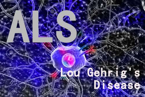 Most people who develop Lou Gehrig's Disease are between the ages of 40 and 70, with an average age of 55 at the time of diagnosis.