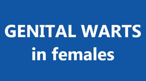 Genital warts can appear any part of the body that is exposed to sexual contact, for example, in women, the vulva, vagina, cervix, or groin.