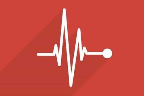 EKG: heart speeds up and slows down randomly
