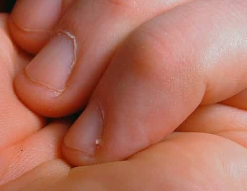 A lot of people don't notice a hangnail up until after it has totally developed and they feel roughness around the nail or pain from inflammation.