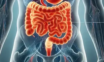 Small Intestine Cancer