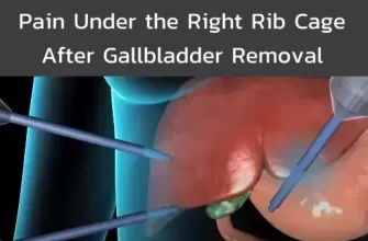 Pain Under the Right Rib Cage After Gallbladder Removal