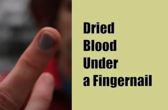 Dried Blood Under a Fingernail